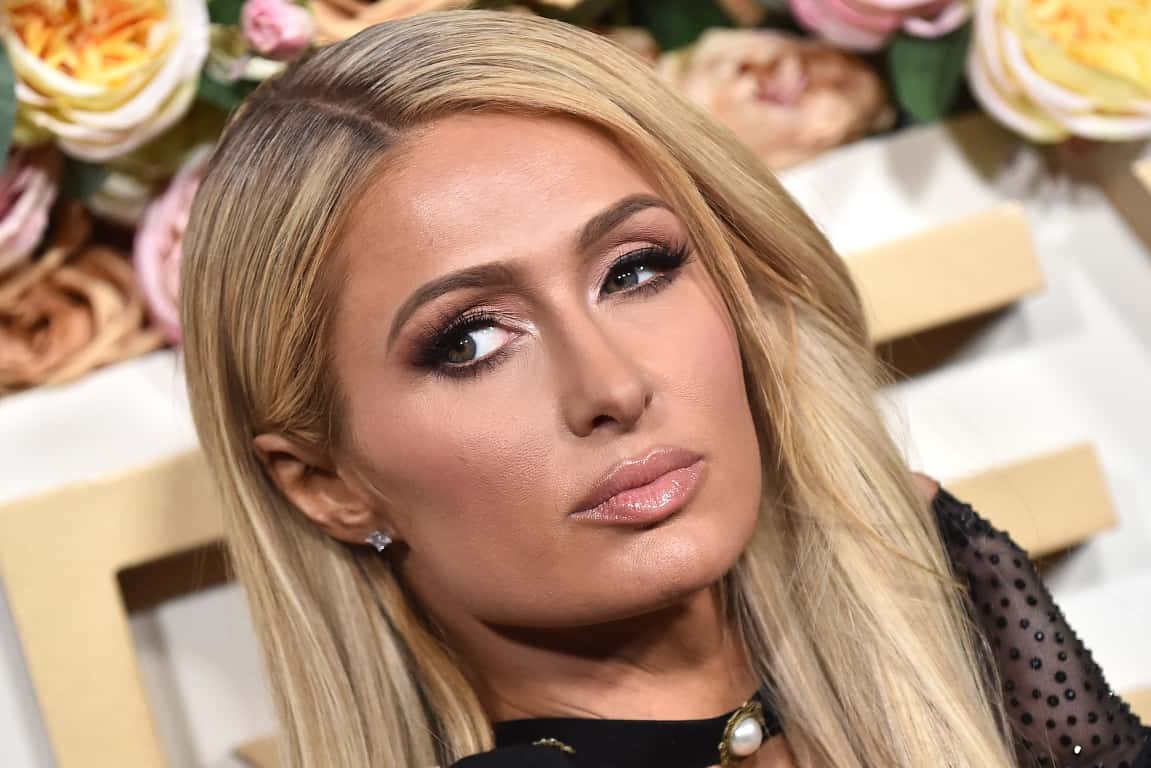 14 Celebrities With Lazy Eye