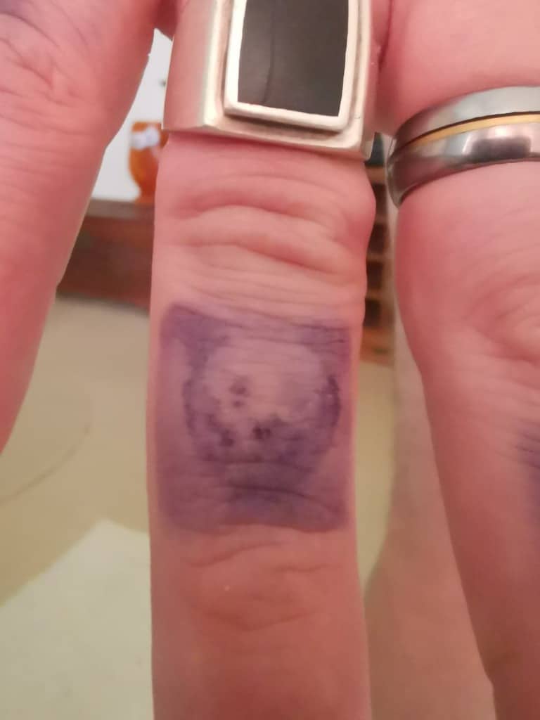 3 Day Mark Close Up Finger