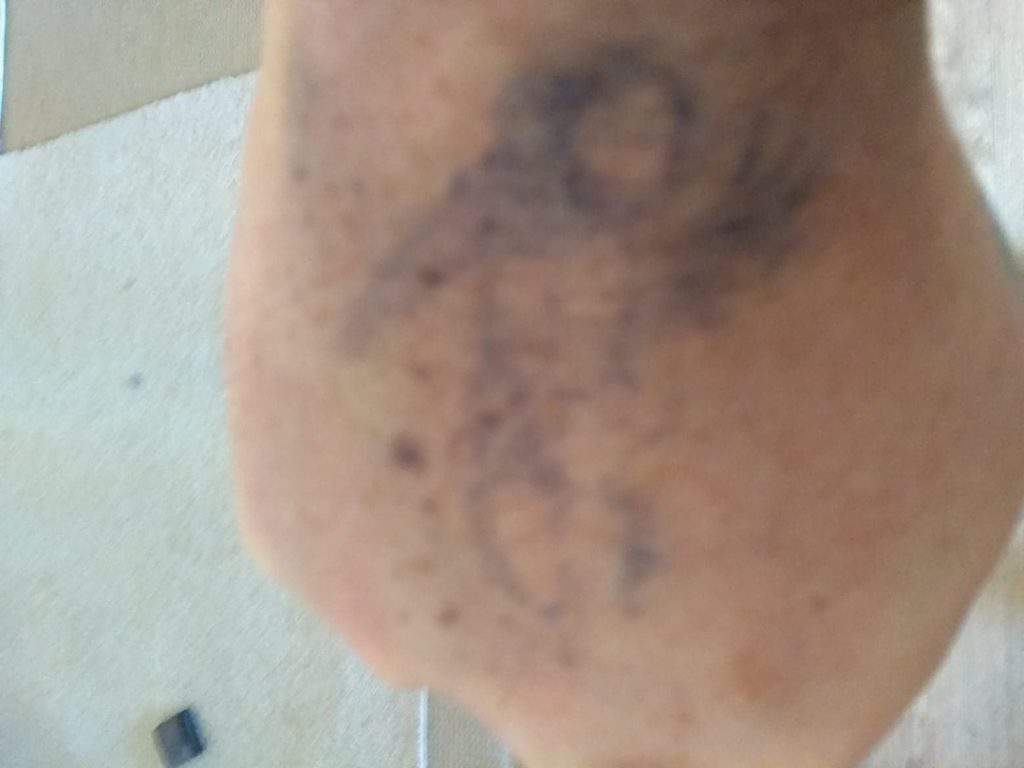 Hand Tattoo After 5 Days