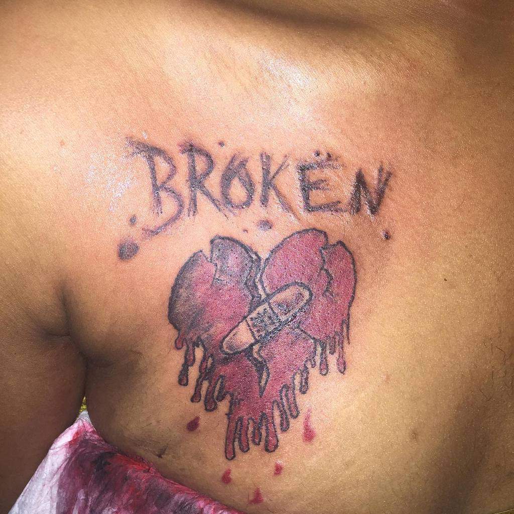 Tattoo of a broken, bandaged heart, bleeding with dripping blood, and the word "BROKEN" above it on a person's chest