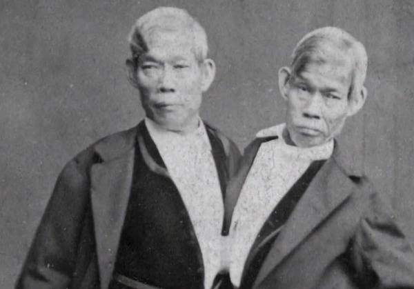 Chang and Eng Bunker