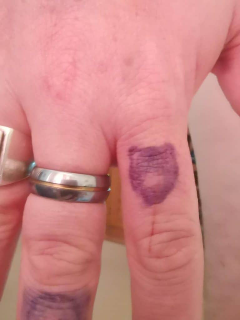 Close Up Finger Day 3