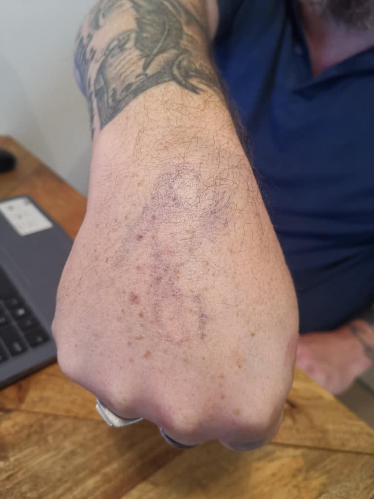 Hand tattoos after 6 days