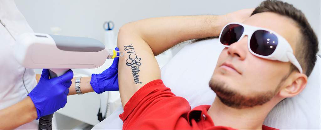 The Cosmetologist removes the patient's tattoo with a neodymium laser