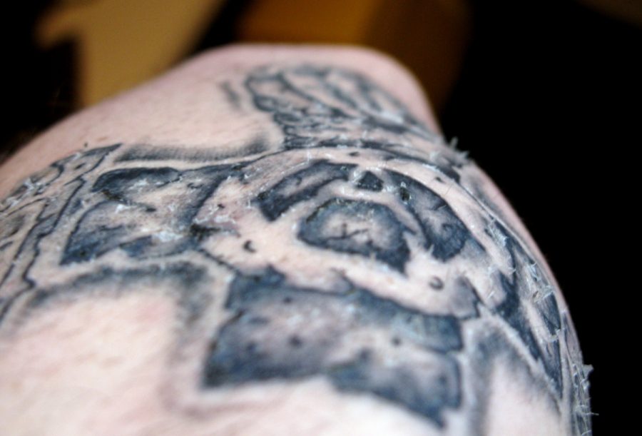 Close-up of a tattoo on skin showing a detailed black and gray design with areas appearing raised and slightly irritated