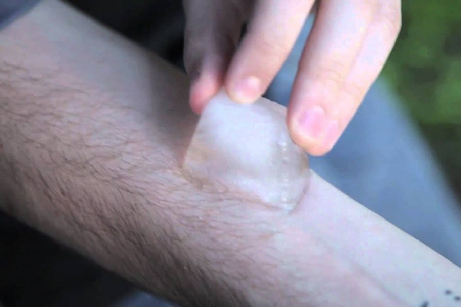 Salt and Ice Challenge