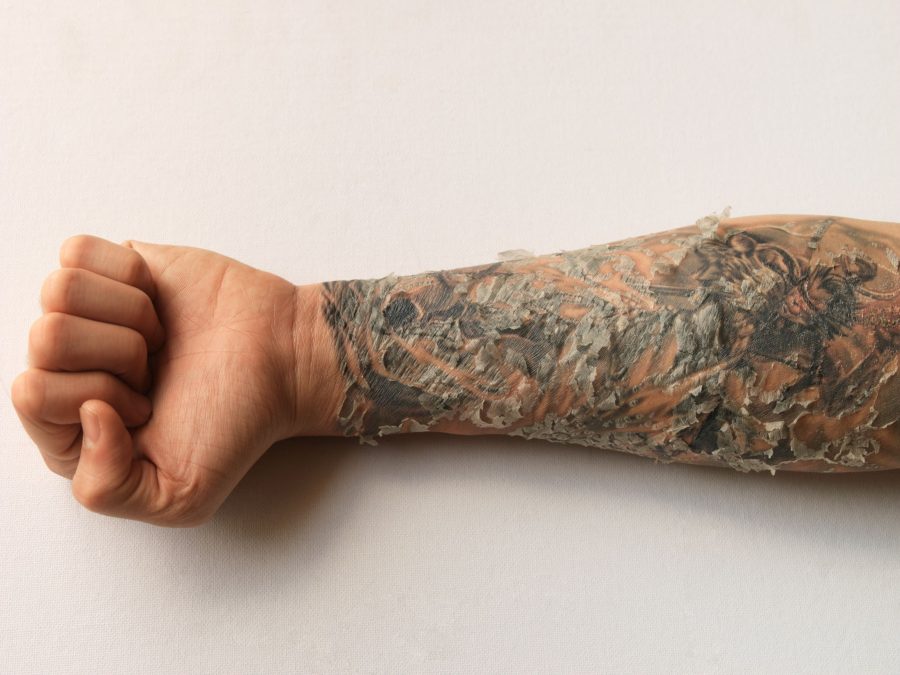 Tattoo Peeling Lower Forearm Haling Process