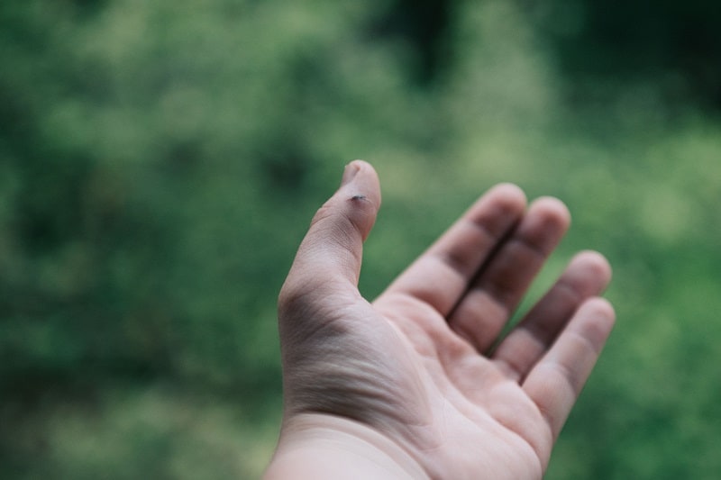Use-a-Pocket-Knife-to-Remove-a-Splinter
