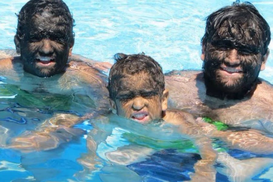 World Record for the Largest Hairy Family