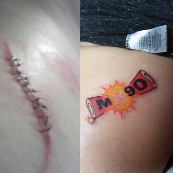 Tattoo of an M-90 firecracker exploding in bright orange and red, designed to mimic a real scar, creating a bold and edgy visual effect.