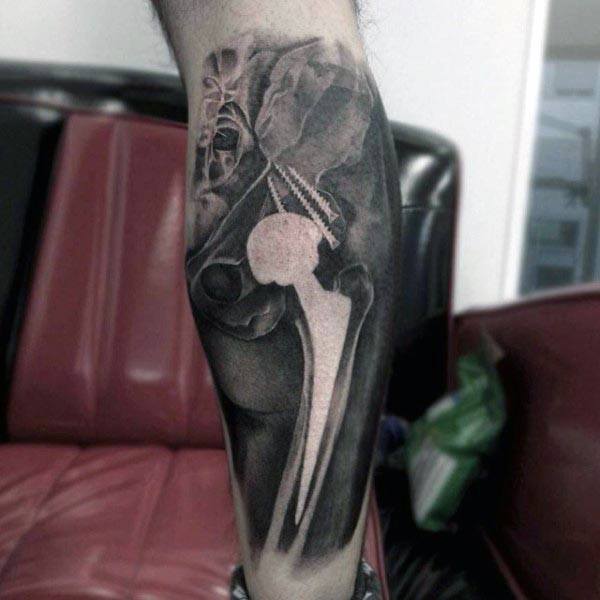 Realistic black and grey leg tattoo of a hip joint with a metallic prosthetic implant, including detailed shading and surgical screws.