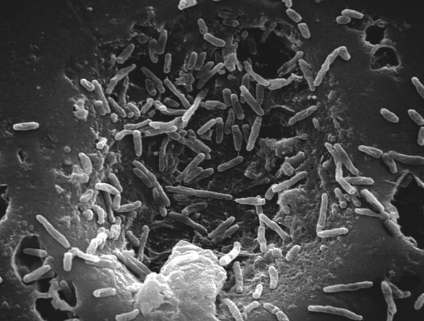 How Do You Know If A Tattoo Is Infected Specific Causes Of Bacteria Growth