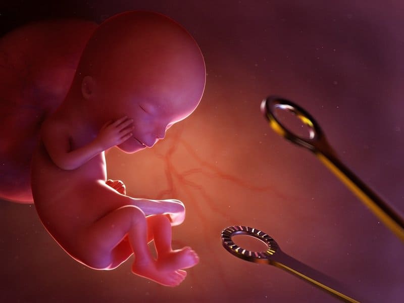 illustration of abortion situation