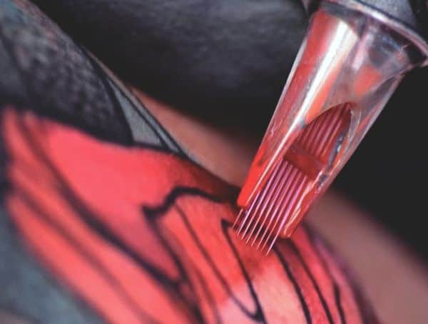 Infected Tattoo General Causes