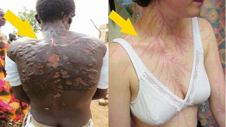 lightning strikes cases