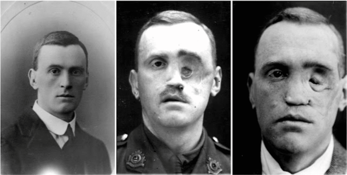 people-before-and-after-war-3