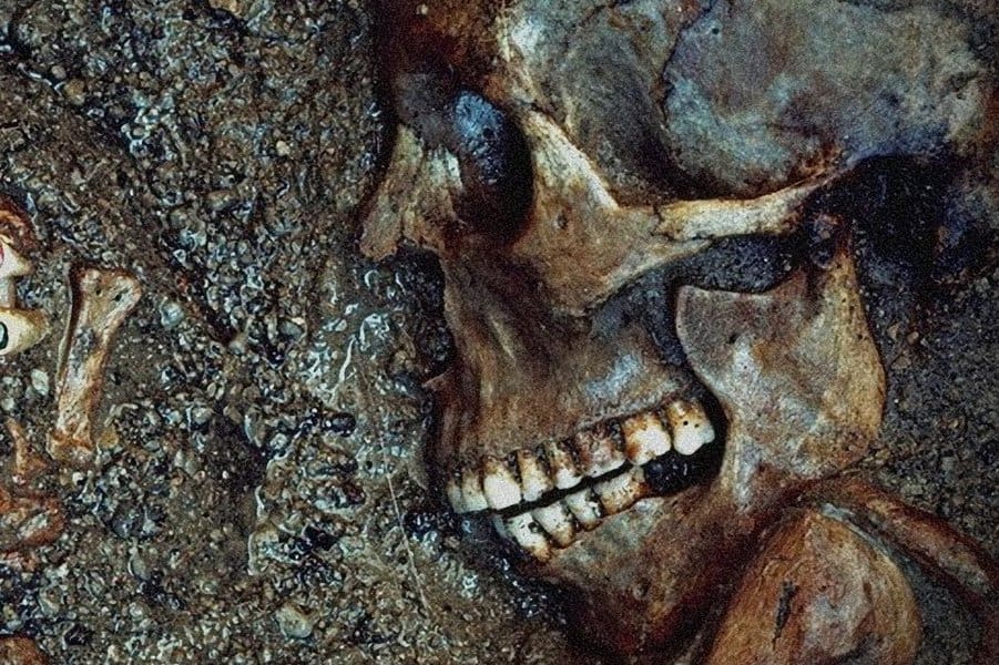 pompeii residents had good teeth