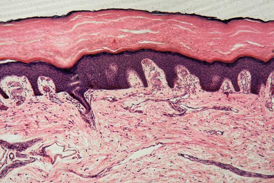 Human,Skin,With,Sweat,Glands,Under,The,Microscope