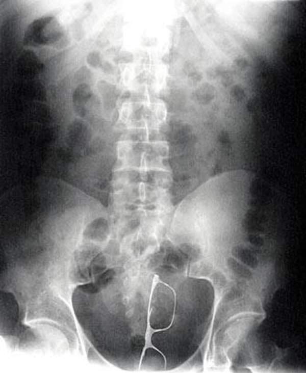 uncomfortable-pictures-13