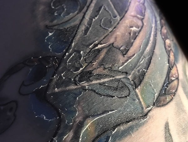 What To Do When Your Tattoo Is Peeling