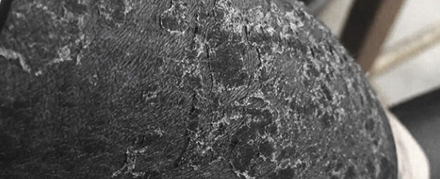 What To Do When Your Tattoo Itches