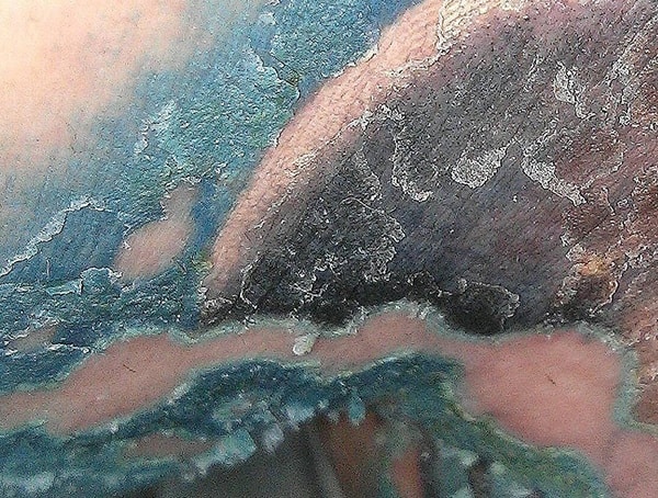 What To Do When Your Tattoo Peels