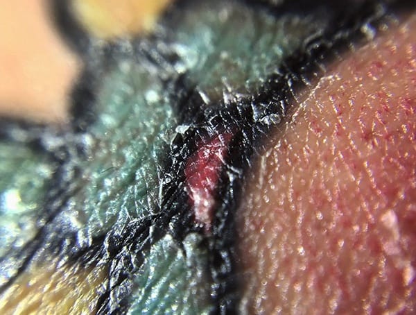 Why Is My Tattoo Itchy